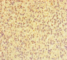 CHTOP Antibody