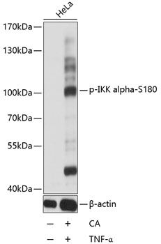CHUK (Phospho-S180) antibody