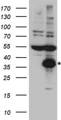 Chymotrypsin like protease (CTRL) antibody