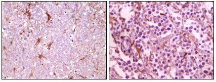 CIB1 Antibody