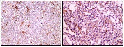 CIB1 Antibody