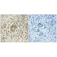 CIB2 Antibody