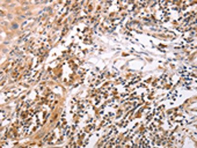 CIDEB Antibody