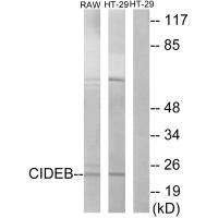 CIDEB antibody