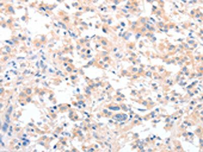 CIDEC Antibody