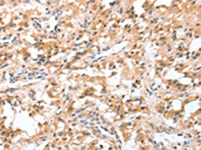 CIDEC Antibody