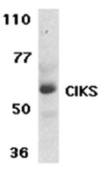 CIKS Antibody