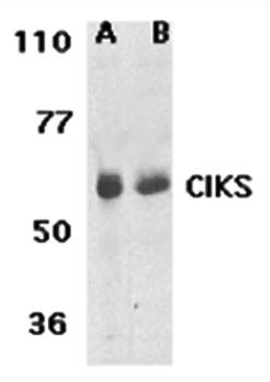 CIKS Antibody