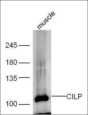CILP antibody