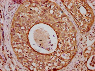 CGN Antibody