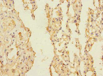 CIR1 antibody