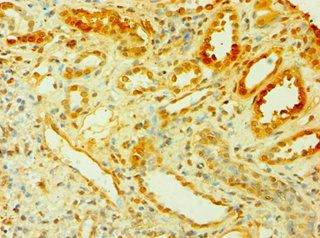 CISH Antibody