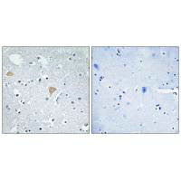 CIT Antibody