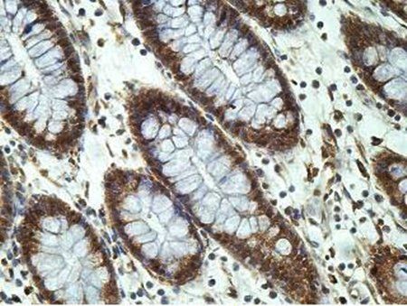 CITED2 Rabbit Polyclonal Antibody
