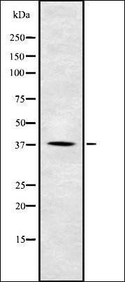 CK-1 alpha (Phospho-Tyr294) antibody