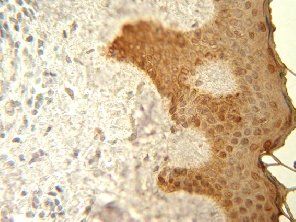 pan Cytokeratin antibody