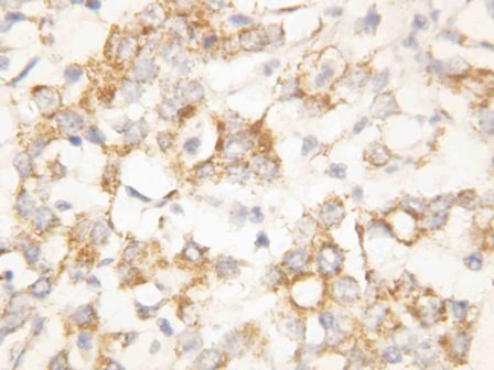 Anti-Cytokeratin 8/KRT8 Antibody