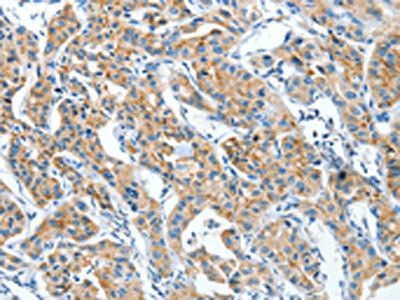 CKAP4 Antibody
