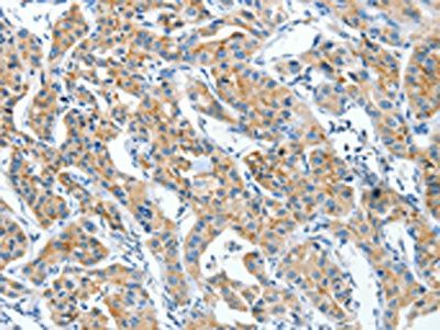 CKAP4 antibody