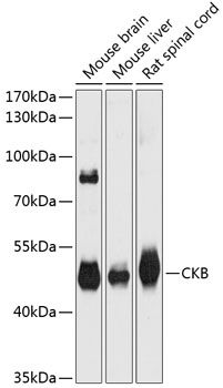 CKB antibody