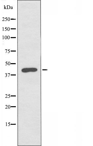 CKI-Epsilon antibody