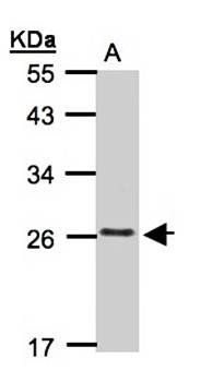 CKLFSF5 antibody