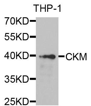 CKM antibody