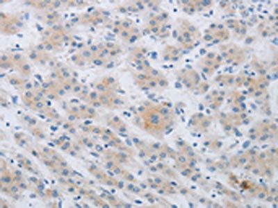 CKMT1A Antibody