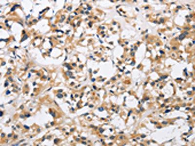 CKMT2 Antibody