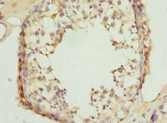 CLASP1 antibody