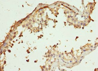 CLTCL1 Antibody