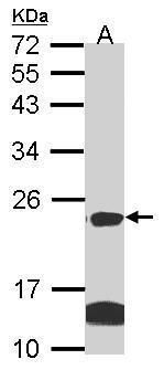 Claudin 14 antibody [C2C3], C-term