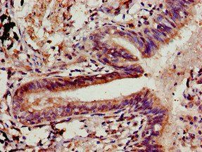 CLDN5 Antibody