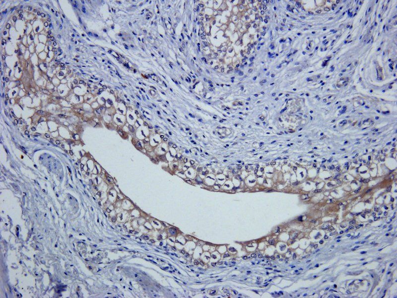 Claudin 1 antibody