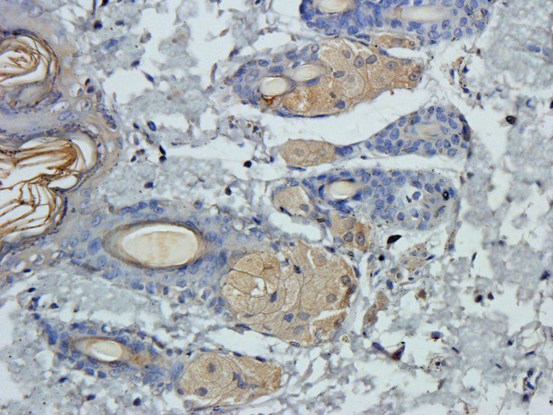 Claudin 1 Rabbit Polyclonal Antibody