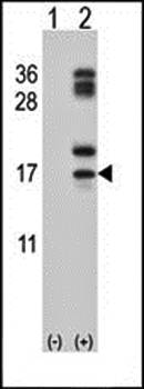 CLC antibody