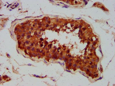 CLCC1 antibody