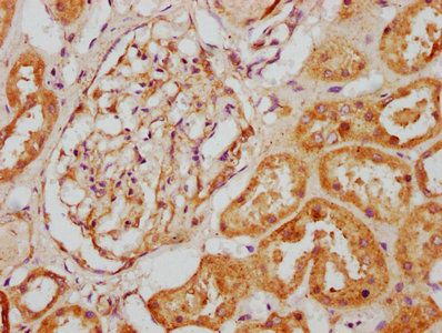 CLCF1 Antibody