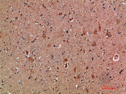 CLCF1 Antibody