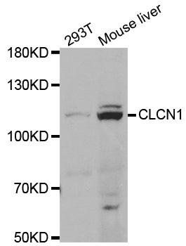CLCN1 antibody