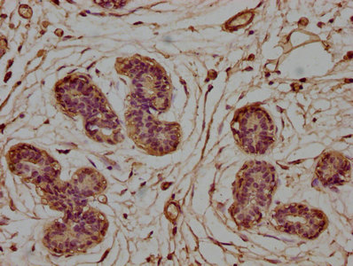 CLCN5 Antibody