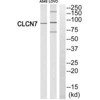 CLCN7 antibody