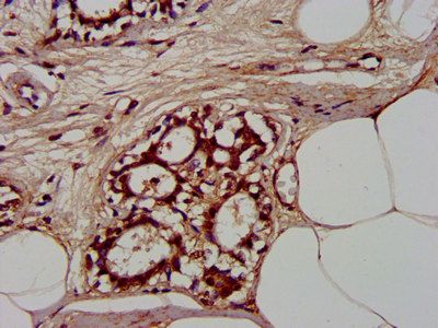 CLCNKB Antibody