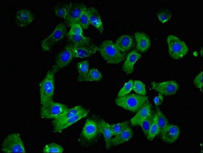 CLDN10 antibody