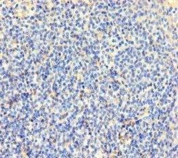 CLDN12 Antibody