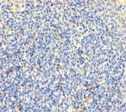 CLDN12 antibody