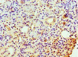 CLDN14 Antibody