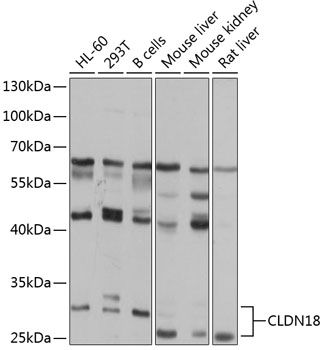 CLDN18 antibody
