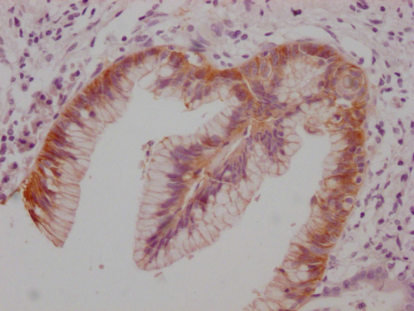 CLDN18 antibody