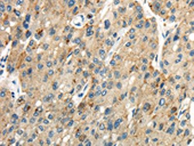 CLDN19 antibody